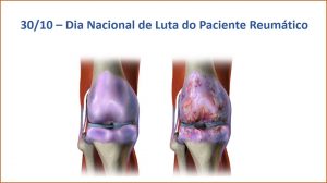 30/10 – Dia Nacional de Luta do Paciente Reumático