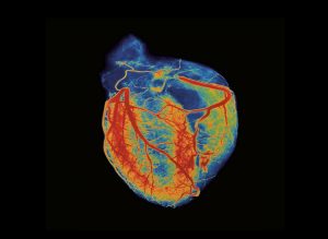 Cerca de 400 mil pessoas morreram em 2022 no Brasil por problemas cardiovasculares