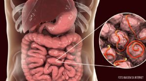 Parasitoses intestinais e seu impacto na sociedade