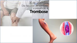 16/9 – Dia Nacional de Combate e Prevenção à Trombose
