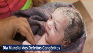 03/3 – Dia Mundial dos Defeitos Congênitos